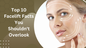 Top 10 Facelift Facts